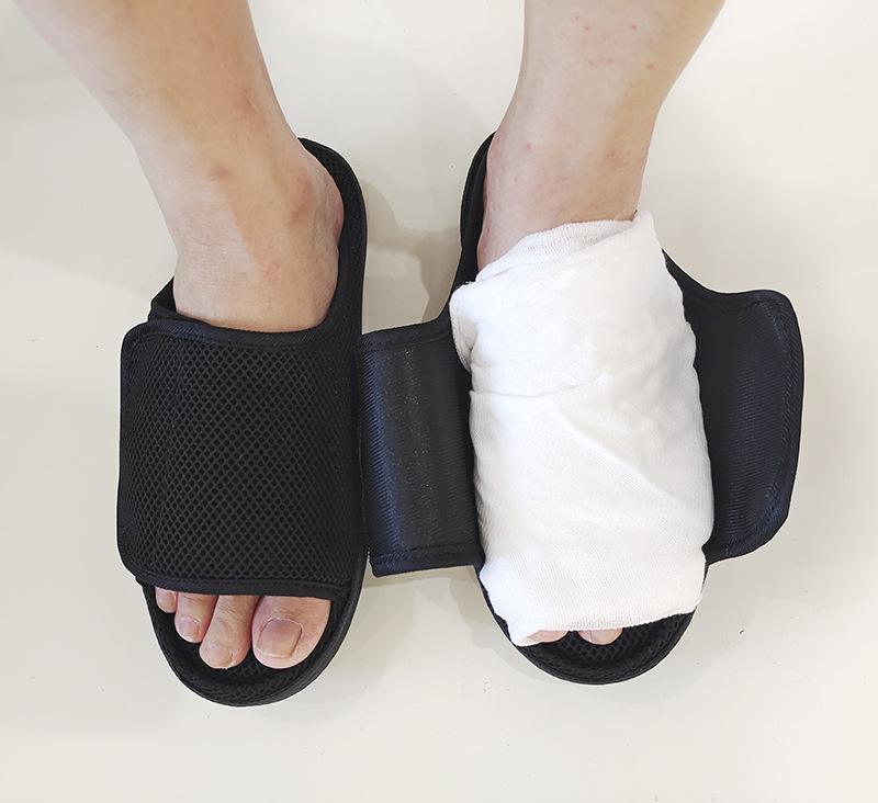 Shoe For Swelling In The Foot Of A Patient After Fracture Surgery foto 4